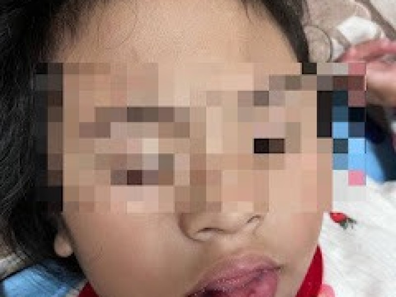 台東特幼班虐童案引眾怒 立委、家長齊聲譴責 要求教育部徹查